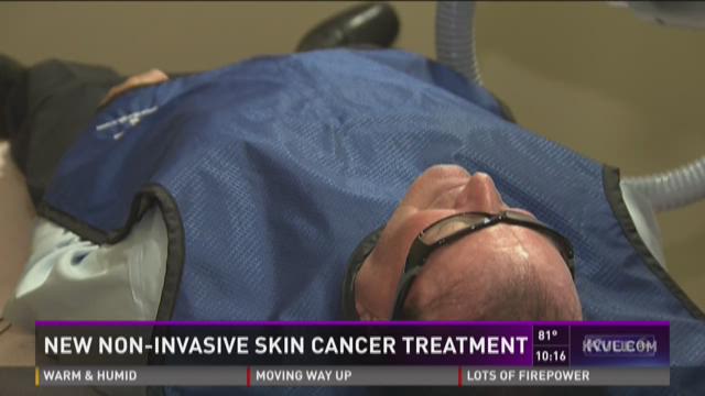 New noninvasive skin cancer treatment